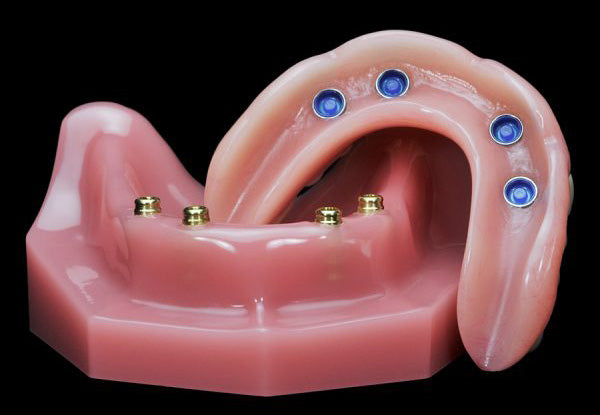 "UltraDense" Acrylic Full Denture