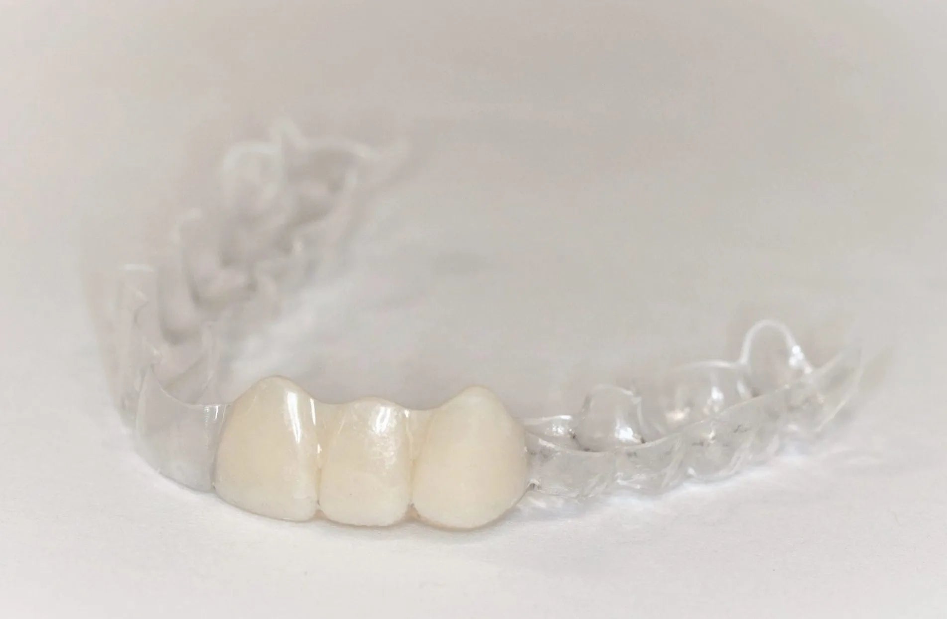 "ClearPath" Essix Retainer