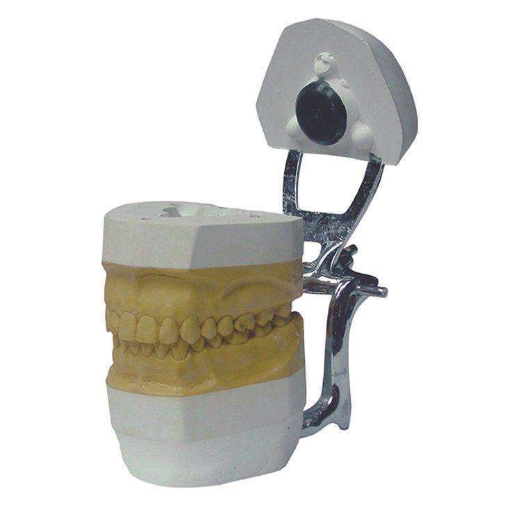 "ArtiFix" Quick-Mount Plaster for Articulators