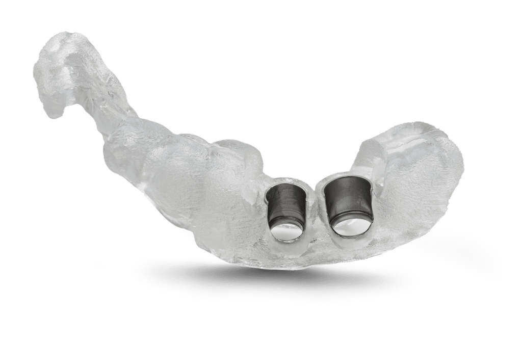 "GuidePlan" Surgical Guide for Dental Implants