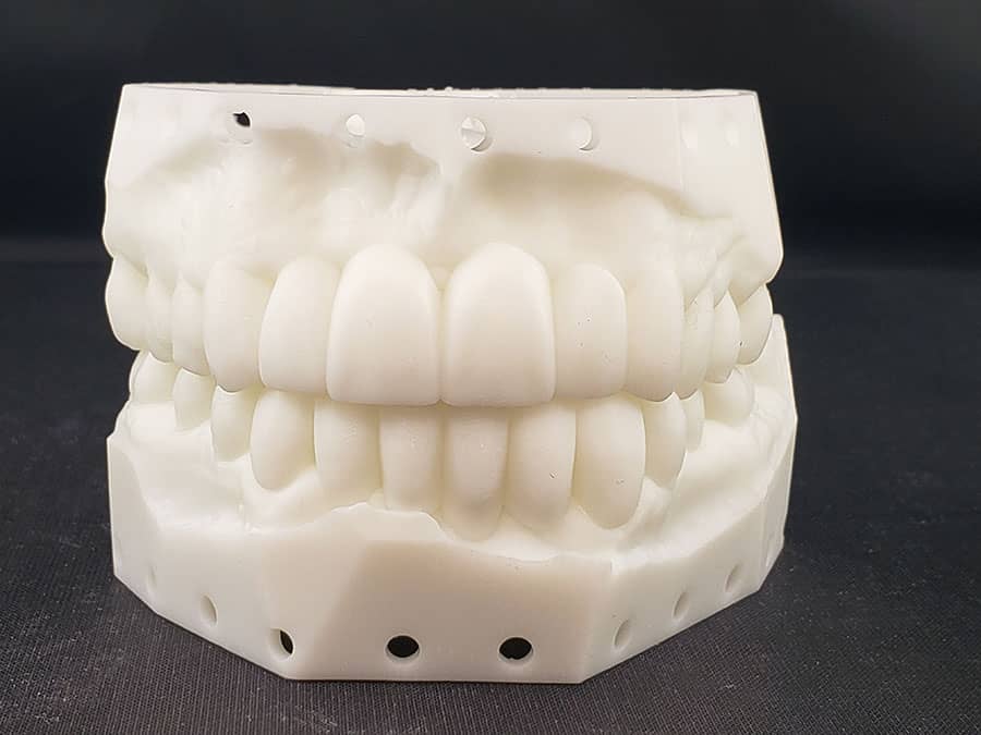 "SmilePreview" Diagnostic Wax-Up Model