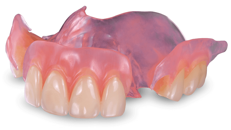 "FlexiComfort" Thermoplastic Partial Denture