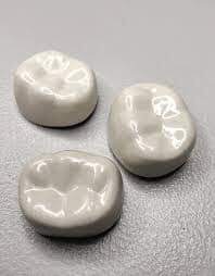 "BioFit" PFM (Porcelain-Fused-to-Metal) Crown