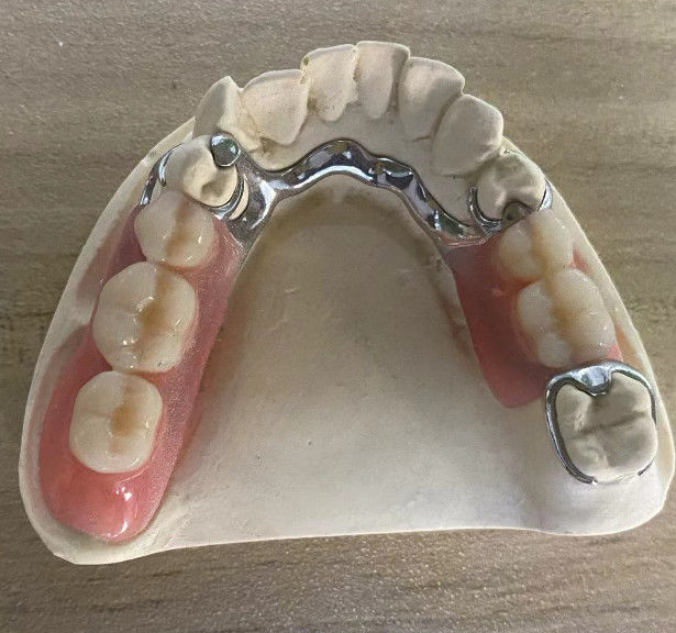 "CobaltChrome" Partial Denture Framework