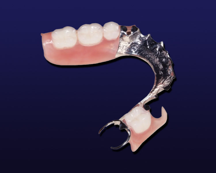 "CobaltChrome" Partial Denture Framework